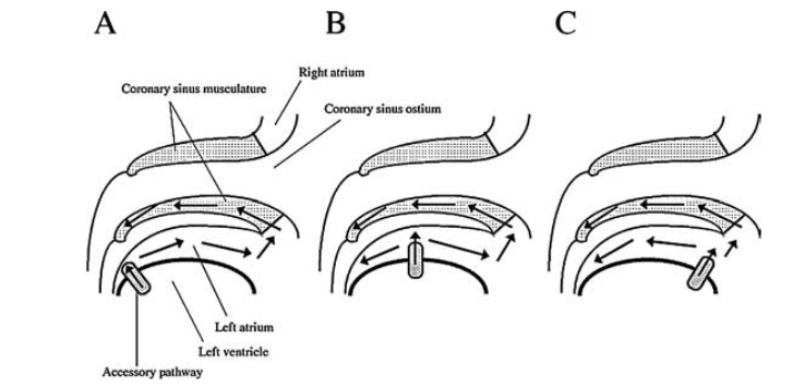 cs_dp_mechanism.png