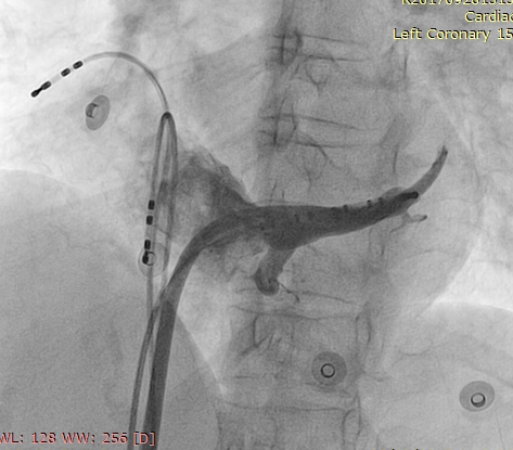 cs_venogram00001.jpg