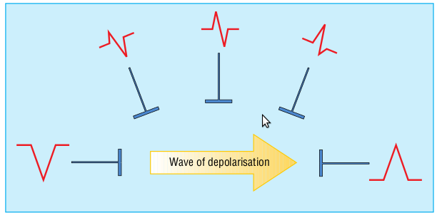 depolarisation_wave.png