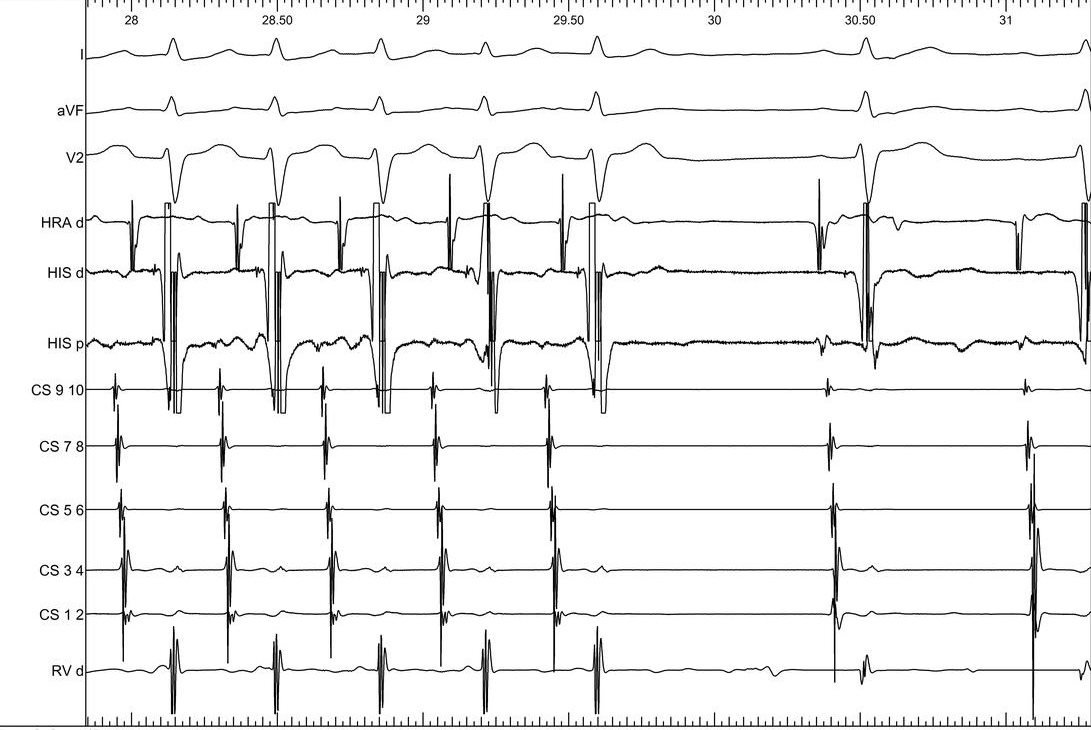 10_term_adenosine.jpg