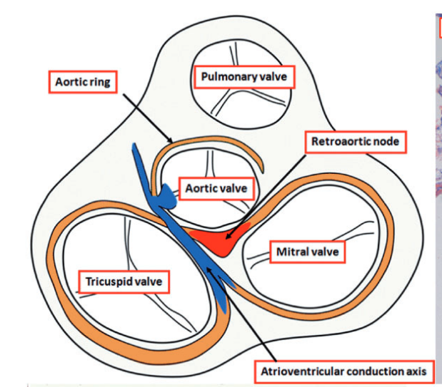 retroaortic_node.png