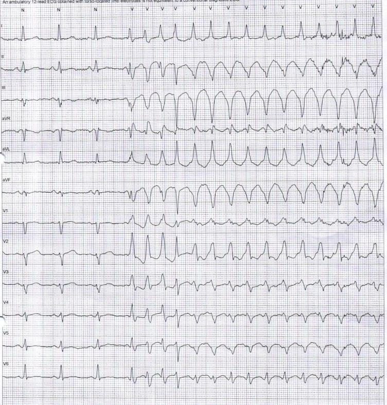 baskar_ecg_001.jpg