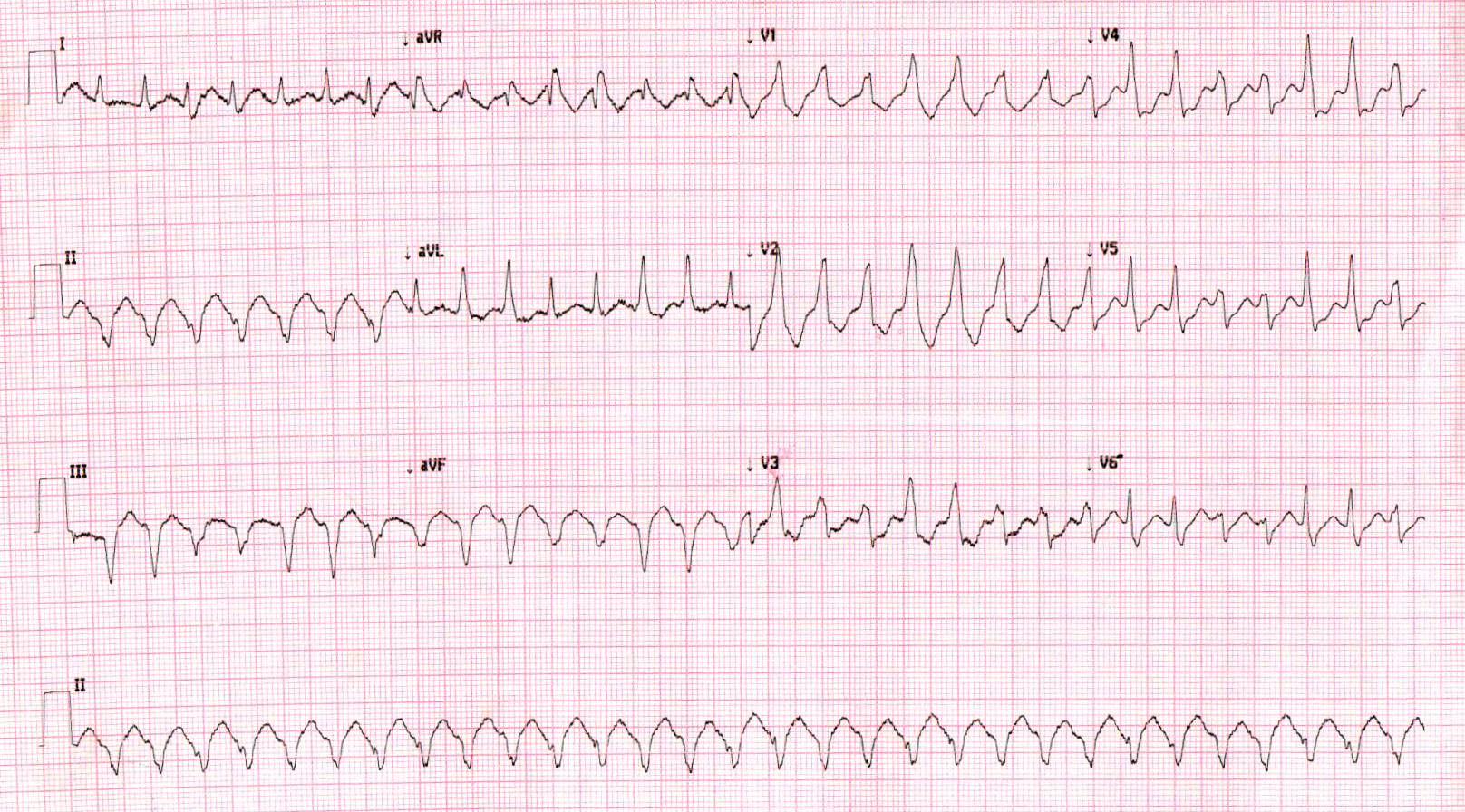 baskar_ecg_002.jpg