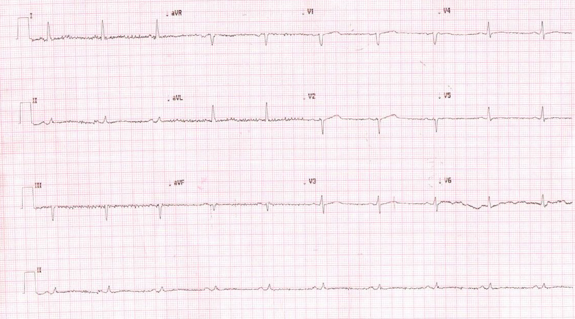 baskar_ecg_003.jpg
