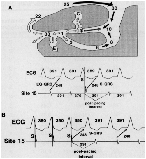 stevenson_reentry_circuit.png