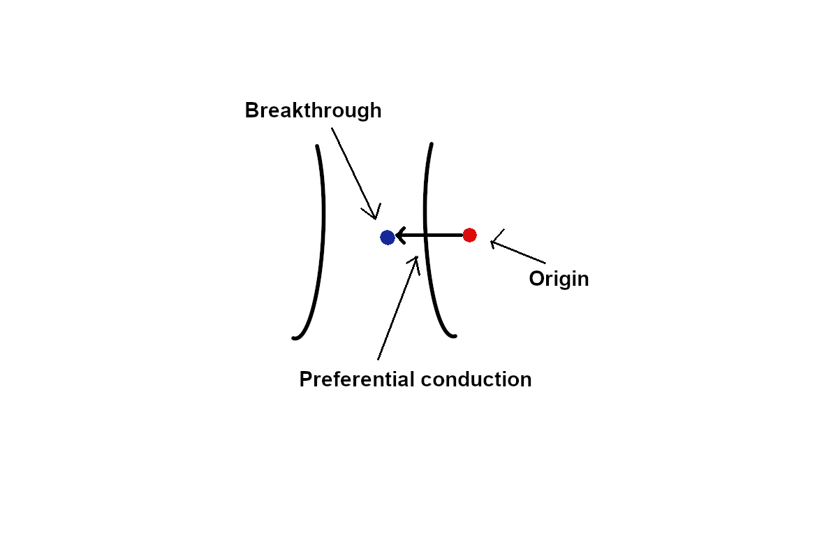 preferential_conduction.png
