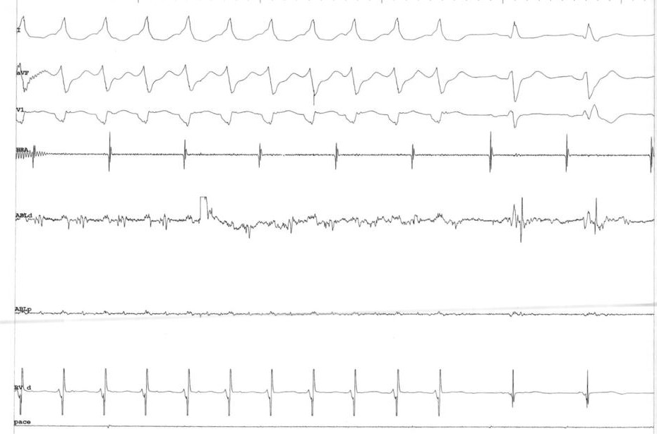 vt_term_ablation.jpg