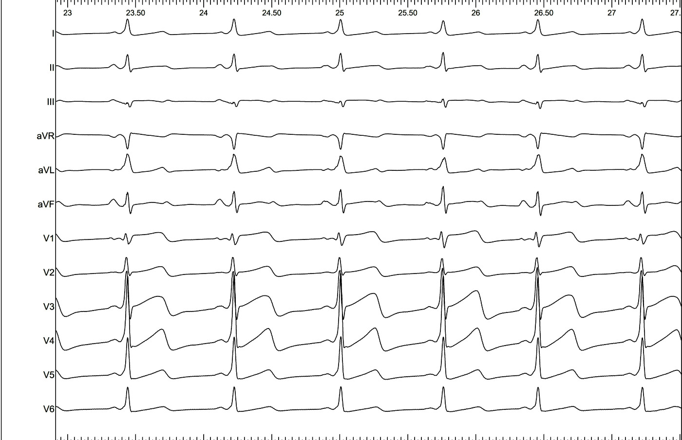 01_baseline_ecg.jpg