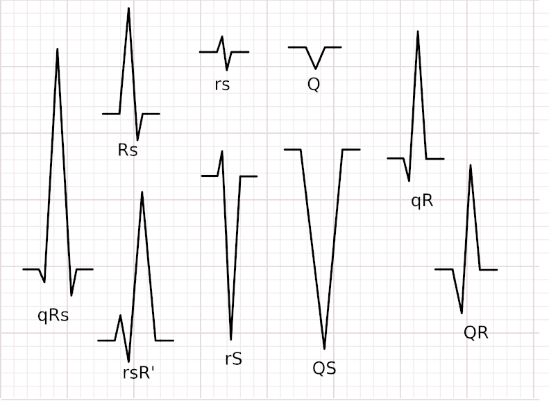 QRS_nomenclature.png