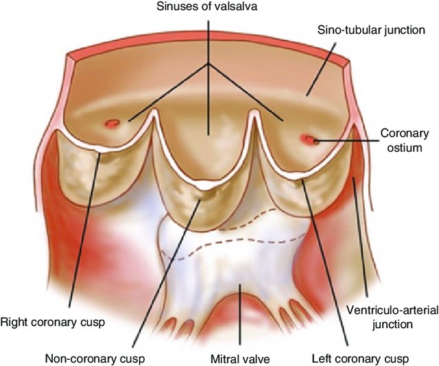 aortic_sinuses.jpg