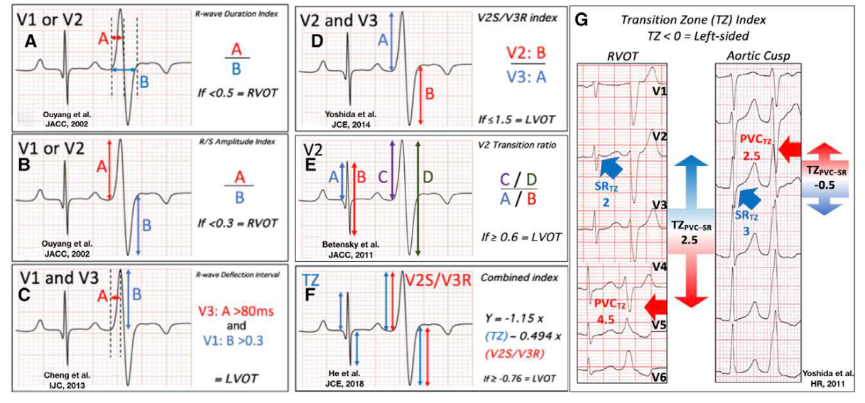 ecg_algorithms.png