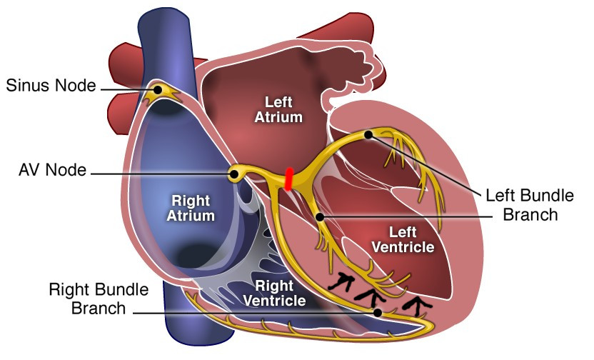 lbbb_activation.jpeg