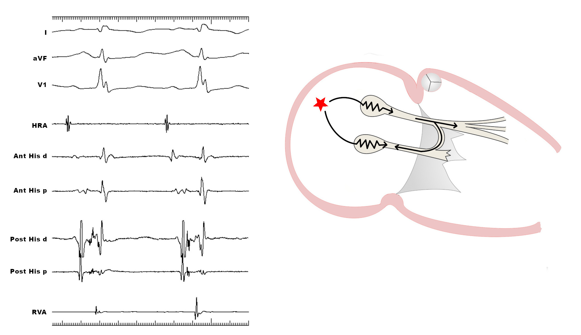 schematic_sinus.jpg