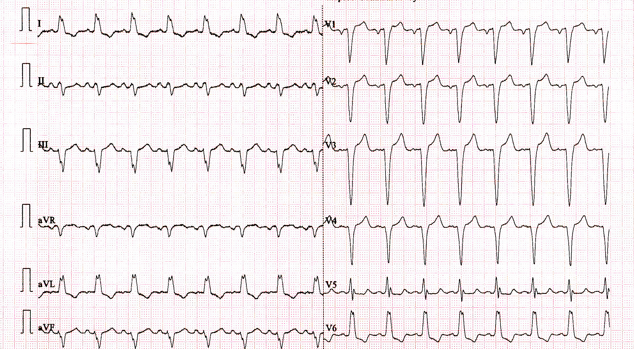 01_sinus_ecg.jpg