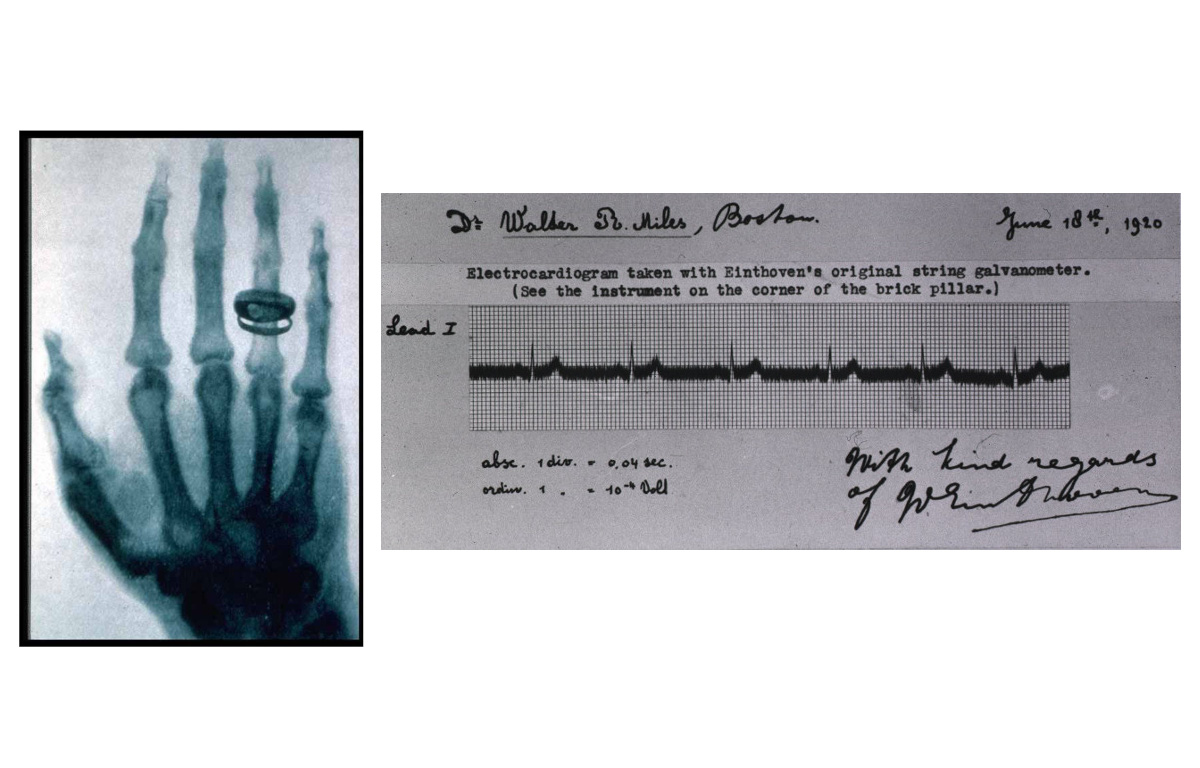 x-ray_ecg.jpg