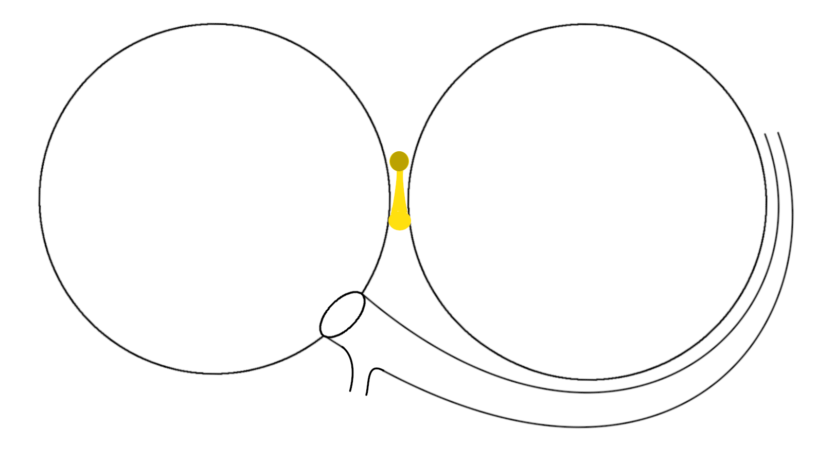 septal_ap1.png