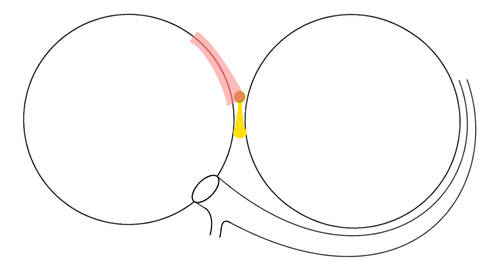 septal_ap2.png