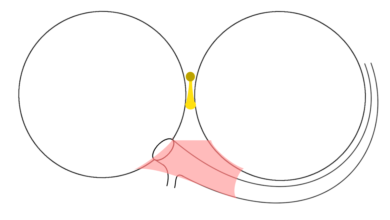septal_ap4.png
