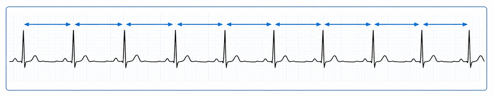 hrv.png