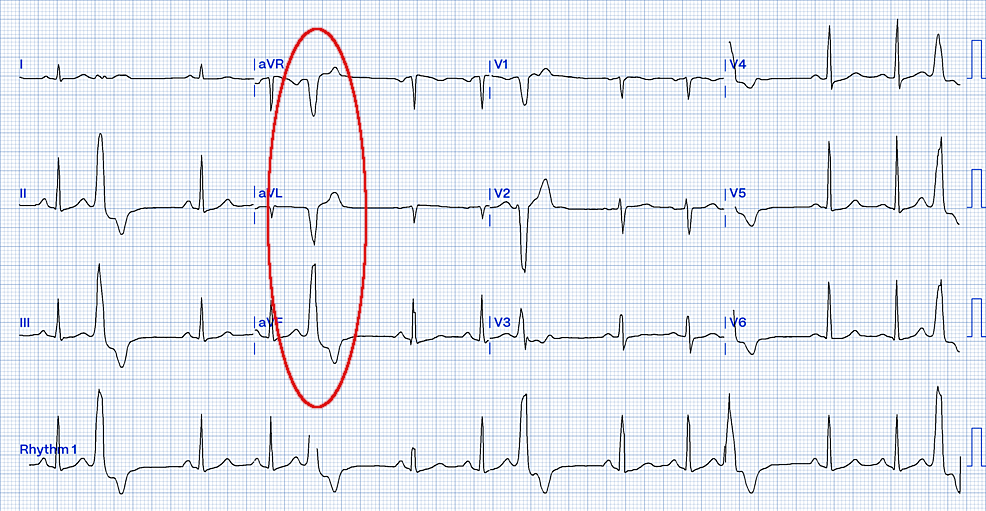 rvot2_1.png