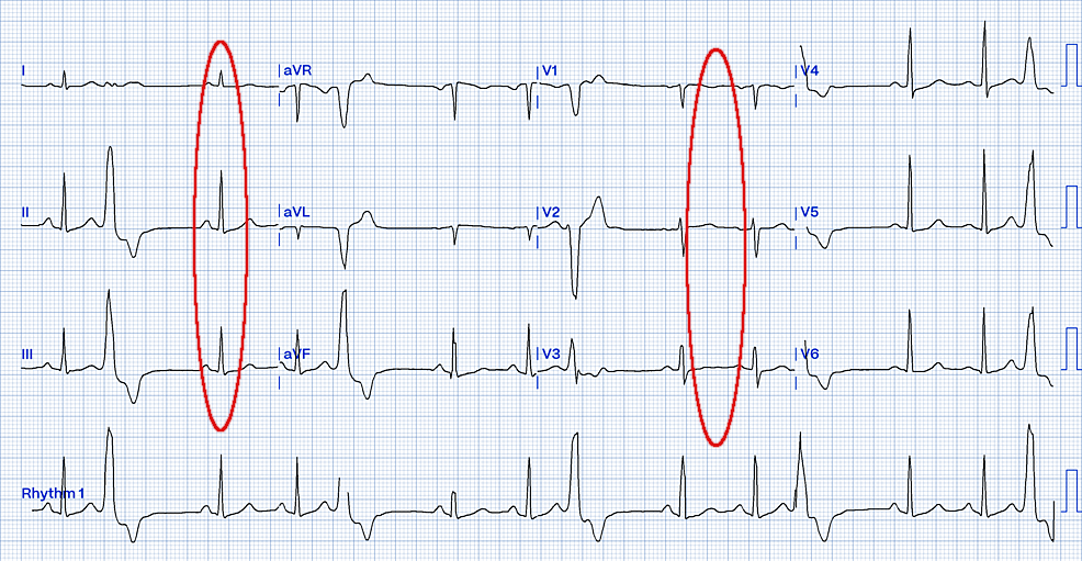 rvot2_2.png